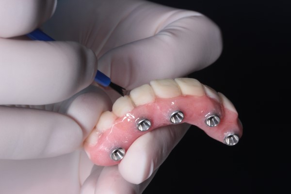 Recovery Tips After An Implant Supported Dentures Procedure